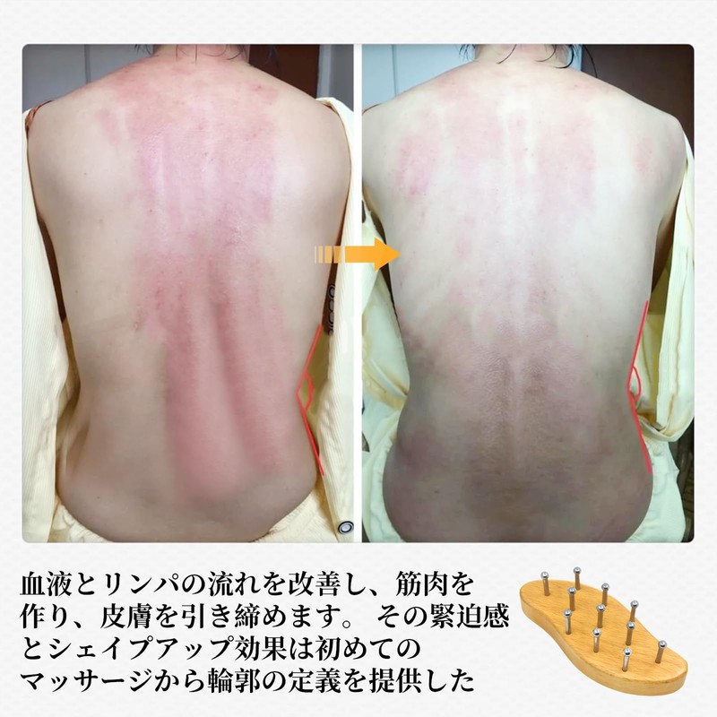 kasanidika Cassis Scalp Massage, Hair Brush, Non-marking Plate Head Massage,