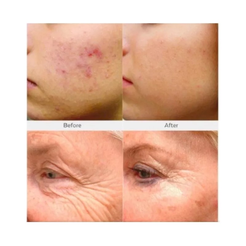 Retinol + Collagen, Hyaluronic Acid, Vitamin C AntiAging Wrinkle Serum