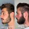The Beard Club Signature Beard Growth Kit - Derma Roller,