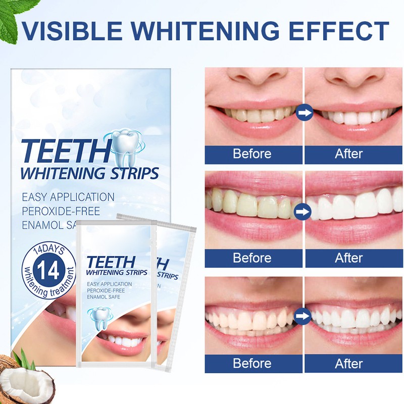 14 Strips Teeth Strips for Sensitive Professional Effects Tartar Removal