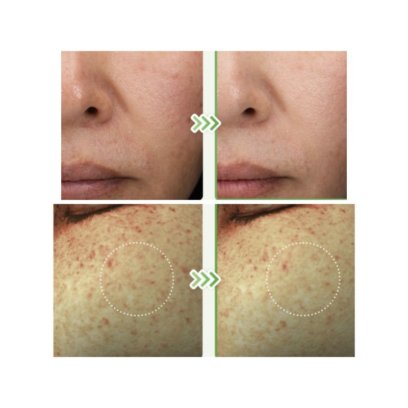 DR.ALTHEA Gentle Vitamin C Serum 30ml