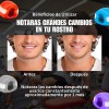 Ejercitador Mandibular Pelota Silicona Cara Cuello Set 3pz F