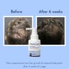WishCare Hair Growth Serum with Rosemary, Redensyl, Anagain, Baicapil, Caffeine,