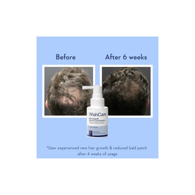 WishCare Hair Growth Serum with Rosemary, Redensyl, Anagain, Baicapil, Caffeine,