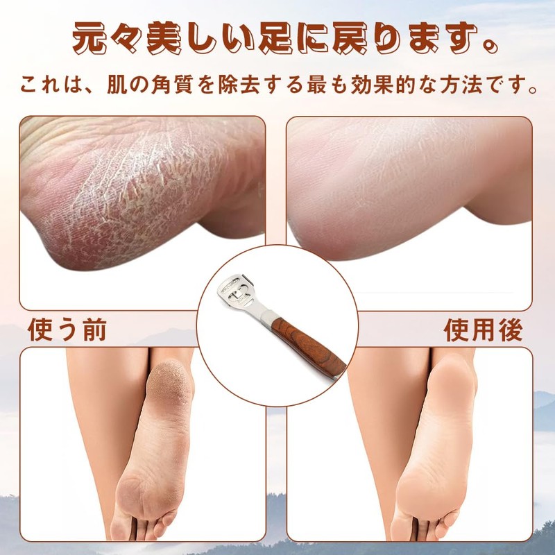 Fish Eye Keratin Sharpener, Fish Eye Cutter, Exfoliating Corn Care,