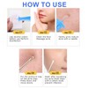 100pcs Blackhead Blemish Remover, Acne Pimple Popper Needle, Pimple Needles,