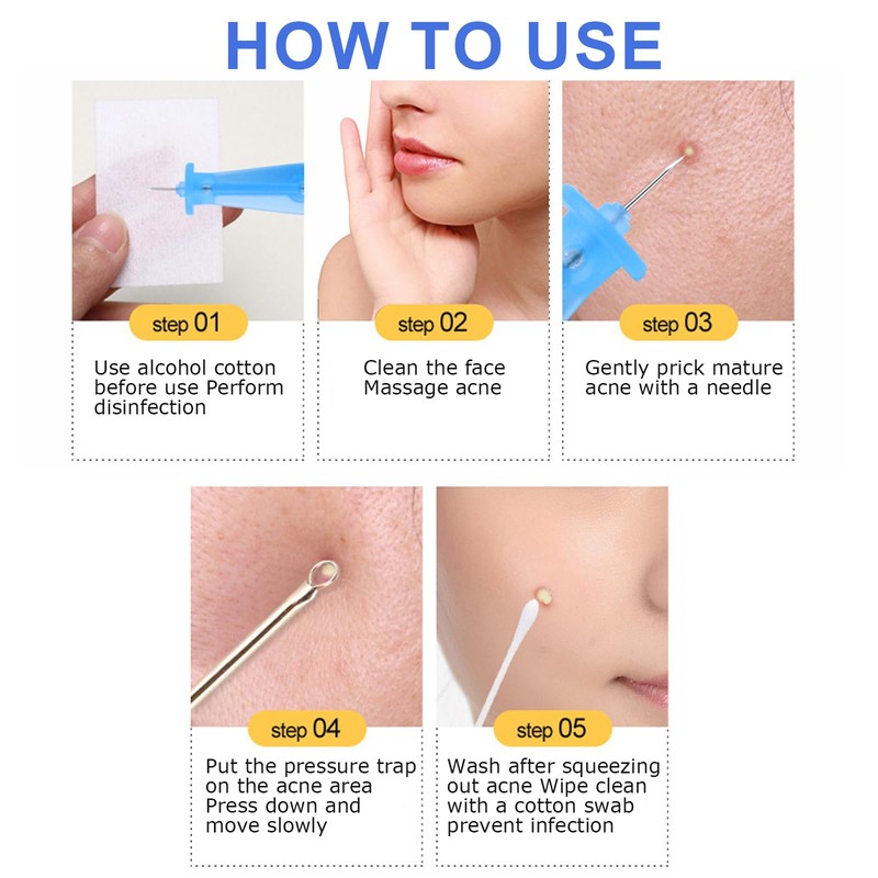 100pcs Blackhead Blemish Remover, Acne Pimple Popper Needle, Pimple Needles,