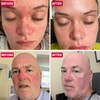 Grahams Natural Anti Redness Face Wash for Rosacea - Facial