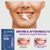 Tiras Blanqueadoras De Dientes Toblemax Con Peróxido De Hidr