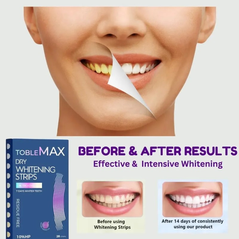 Tiras Blanqueadoras De Dientes Toblemax Con Peróxido De Hidr