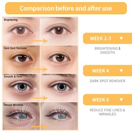 BREYLEE Vitamin C Serum for Face & Eye (o.6 oz) for Brightening Skin,Dark Spot Remover,Reduce Wrinkle,Anti Aging Serum,Moisturizer Brightening Serum with Hyaluronic Acid,Vitamin E,Retinol, Niacinamide