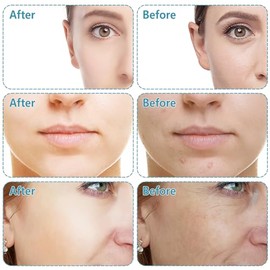 GeeRic 2 Un Rodillo Facial Ice Globes,Masaje de Hielo Bola,Bola de Belleza de Hielo Facial, Masajeadores Faciales Para Piel Fría,Educe la Hinchazón y 