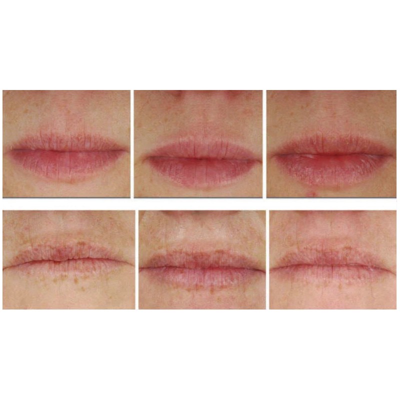 CREMA ANTIARRUGAS LABIO SUPERIOR TRIPLE SUAVE ELIMINA ARRUGAS EN LOS