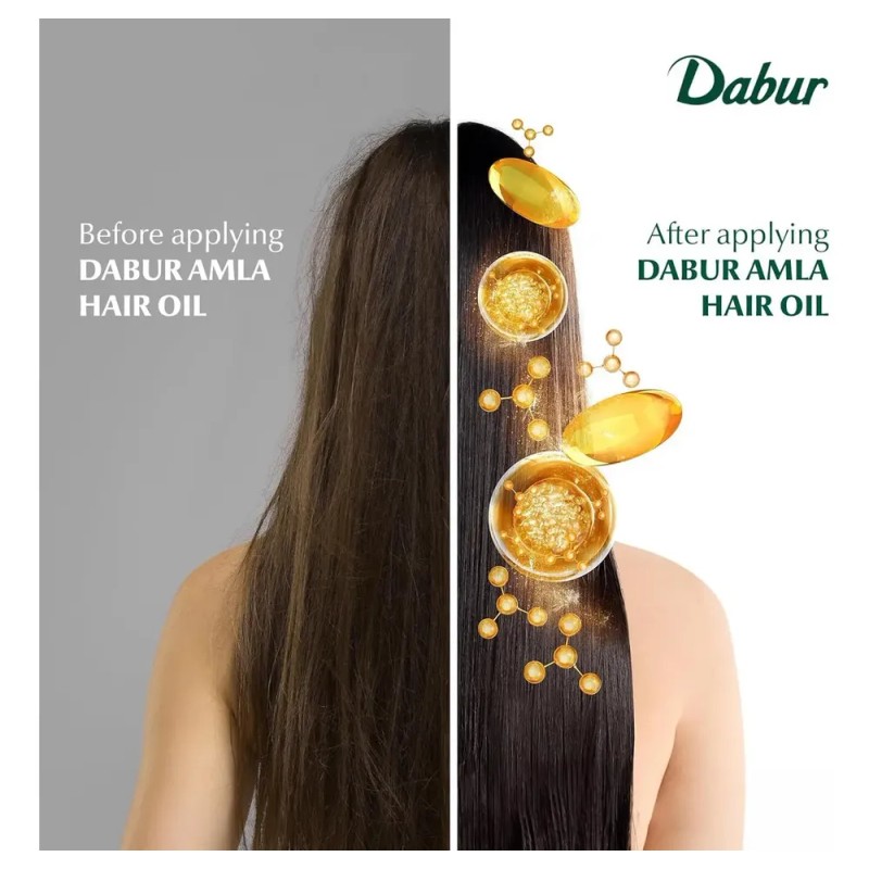 Aceite Para El Cabello Dabur Amla 296 Ml