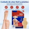 / Parches Uñas Hongos 126 Tratamiento Antifúngico //