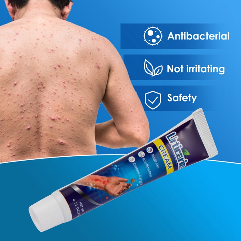 Urticaria Antipruritic Cream 20g Natural Herbal Anti Itch Ointment