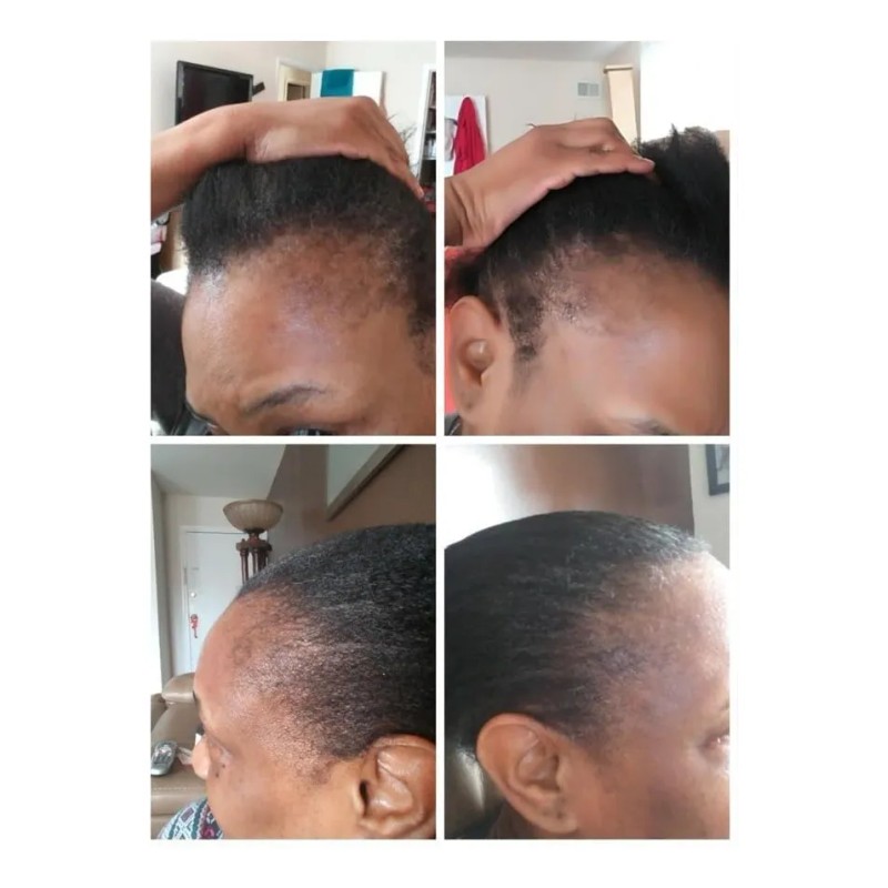 Aceite De Ricino Kreyol Essence Haitian Black Para Piel Y