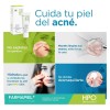 Hidrogel Antibacteriano Piel Grasa Tratamiento Acné Hpo 30ml