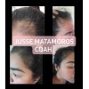 Jusse Para Damas Crecimiento Cabello Cejas Anti Caída Aceite Jusse