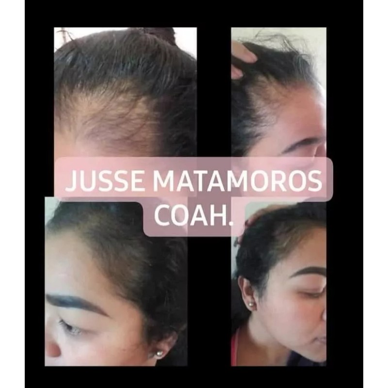 Jusse Para Damas Crecimiento Cabello Cejas Anti Caída Aceite Jusse