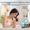 Roycederm- Alivio rápido para afecciones del cuero cabelludo: aproveche el