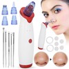 Blackhead Removal Rechargeable 5 Adjustable Suction Electric Pore Acne Cleaner