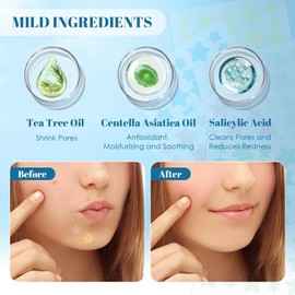 Pickel Patch, 255 Stück Hydrokolloid Pflaster gegen Pickel mit Salicylsäure & Teebaumöl, Unsichtbare Pickel Patch für Tag und Nacht, Wasserdicht & Atmungsaktiv, 2-in-1 Anti Akne-Patches