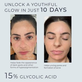 InstaSkincare Glycolic Acid Serum for Face 15% Strength - Extra Large Size (8Oz) - Advanced Formula for Enhancing Skin Radiance, Texture Improvement, Addressing Uneven Tone & Fine Lines