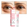 Crema Eye Rollerball Que Reafirma La Piel E Ilumina El