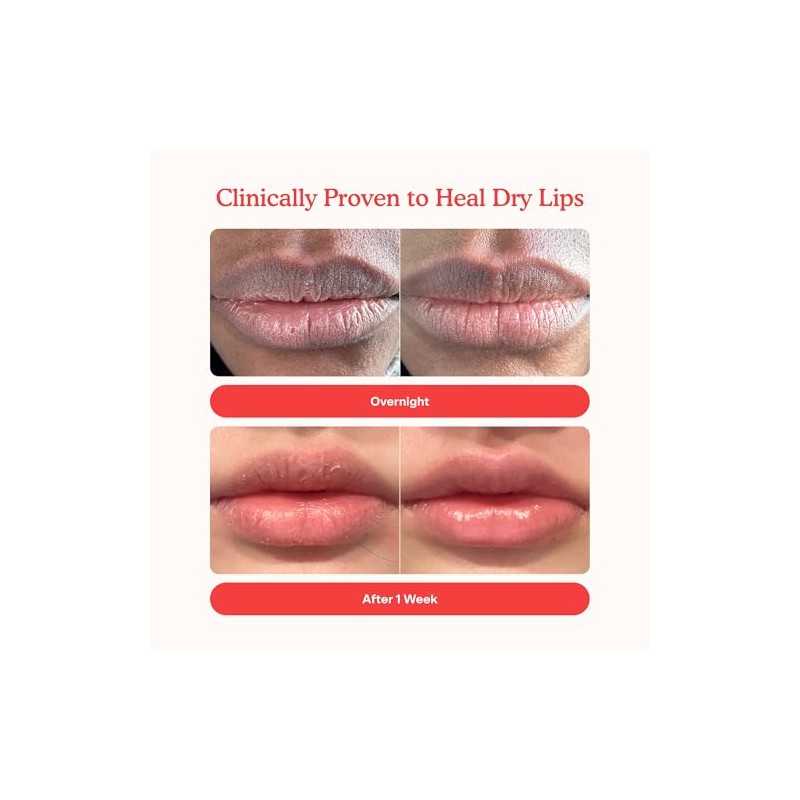 Bálsamo hidratante para labios Lip Softie (uva y vainilla)