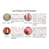 500gr Crema Mas Suave, Pomada Nopsor 125gr Aux. Tx Psoriasis