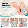 Electric Feet Callus Remover Foot File Electric Callus Remover Feet