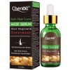 Hair Growth Serum - Treats Hair Loss & Thinning, Stimulates