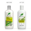Dr. Organic Tea Tree Conditioner, Cleansing, Oily Roots & Scalp,