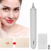 Mole Removal Pen USB 3 Gears Adjustment Freckle Spots Removal