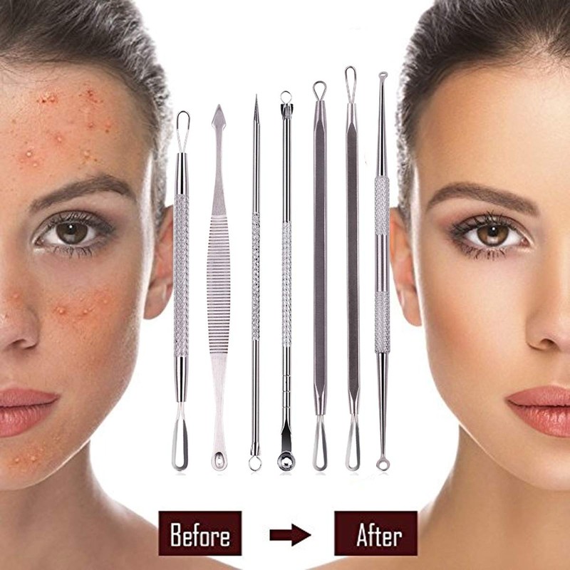 LUPO Comedones/Blackhead Remover Set – Stainless Steel Double Tool Kit – (Pack of 7)