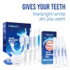 VieBeauti Teeth Whitening Pen (4 Pcs), 40+ Uses, Effective, Painless,