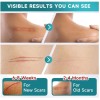 Pumkot Silicone Scar Tape Roll 1.6"x120" Surgical Scars Keloid Burn