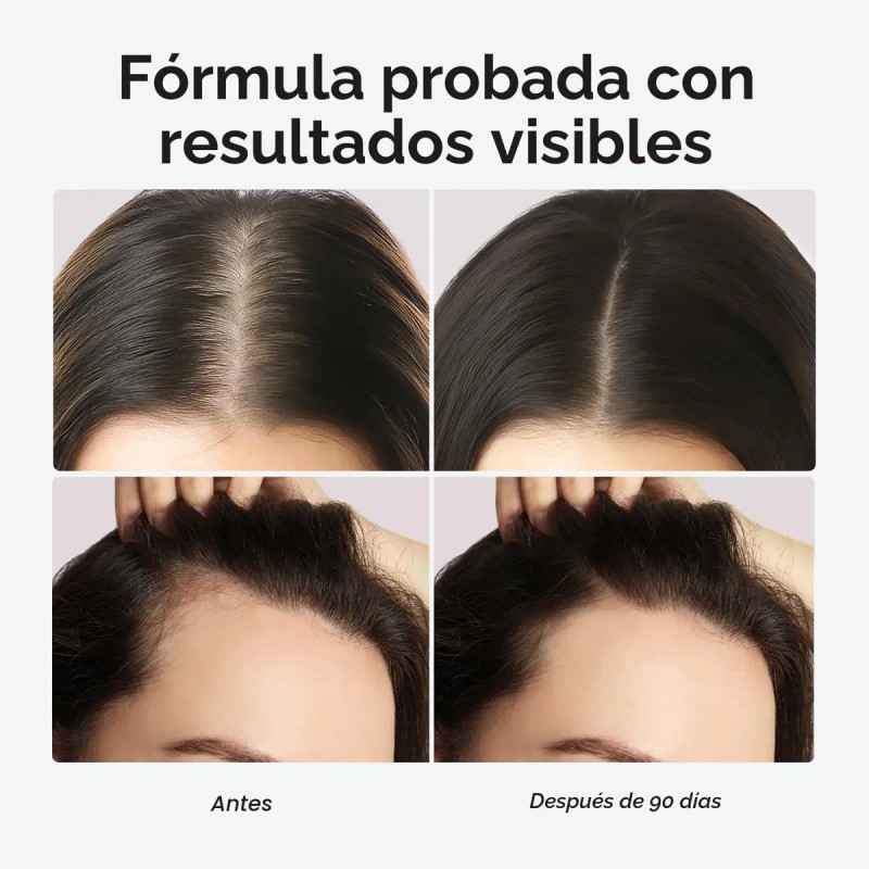 Maree Vitaminas Crecimiento Cabello 120 Capsulas
