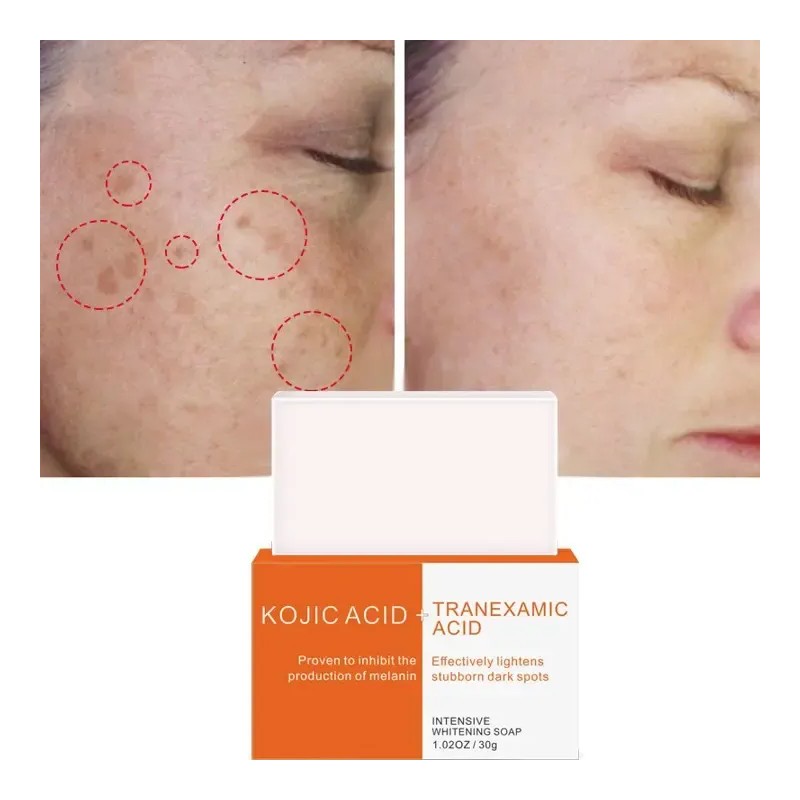 Jabón Facial Kójic Tranexámico 30g Mancha Melasma (2 Piezas)