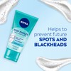 NIVEA Stop Pimples Daily Wash Scrub 150ml