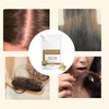 300ml Anti Hair Loss Shampoo, Moisturizing And Promoting Hair Growth,
