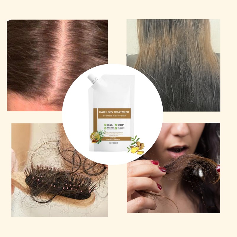300ml Anti Hair Loss Shampoo, Moisturizing And Promoting Hair Growth,