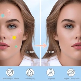 Parches para Acne, 240 Almohadillas Hidrocoloides para Espinillas, Pimple Patch, Parches hidrocoloides absorbentes para tratar la erupción de acné y e