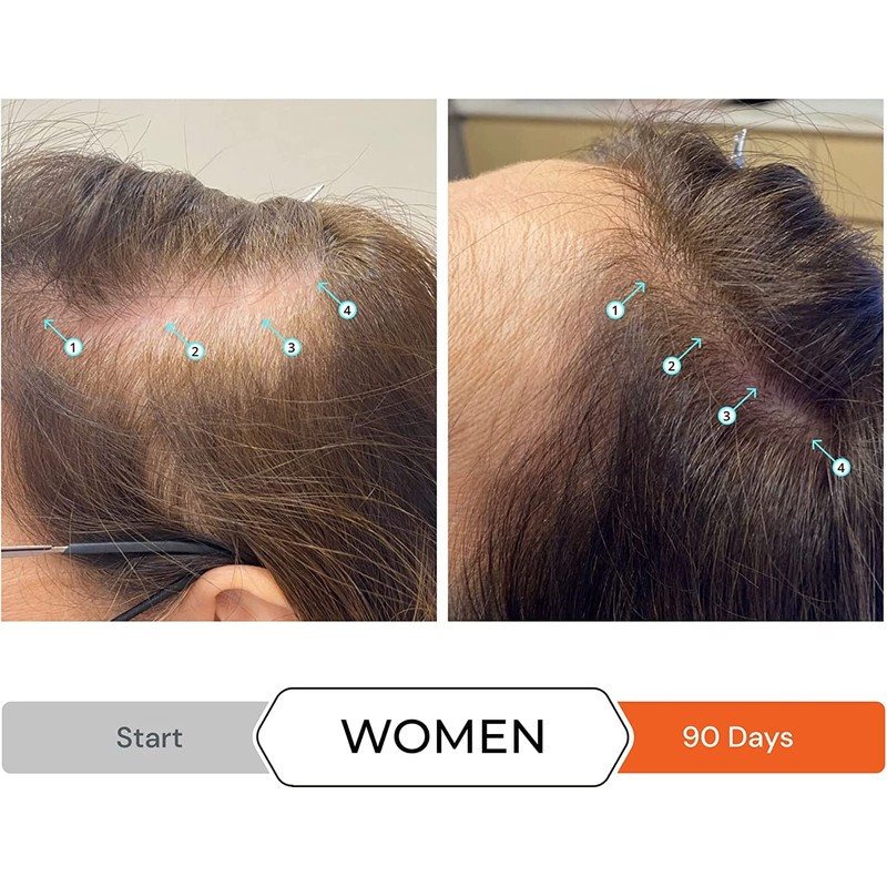 Revita Hair Loss Conditioner 205ml