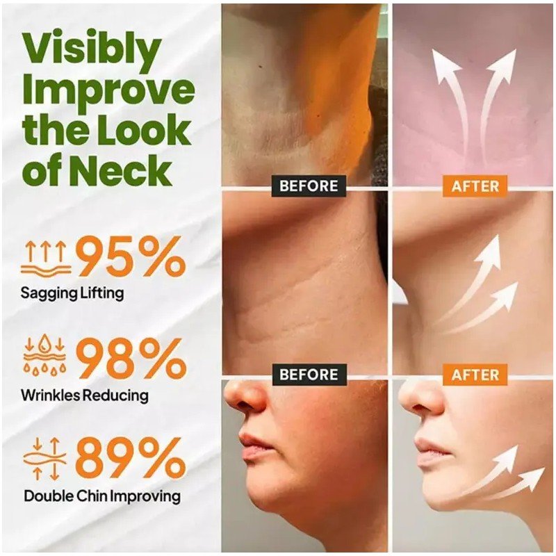 2x Neck Cream Tighten & Lift Firming, Neck Firming Cream