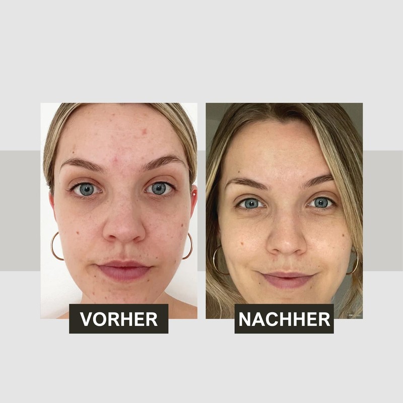 Mineralium Dead Sea HydraSource Facial Toner fo Normal and Dry