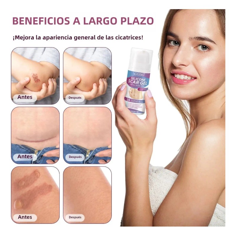 Scar Gel Vogsig Elimina Cicatrices Queloide Abdominoplastia