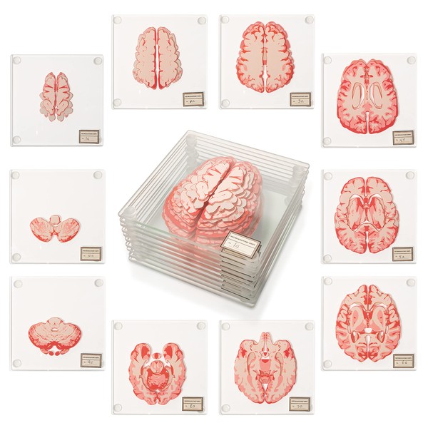 Anatomic Brain Specimen Coasters (Set of 10) - Neuroscience Gifts