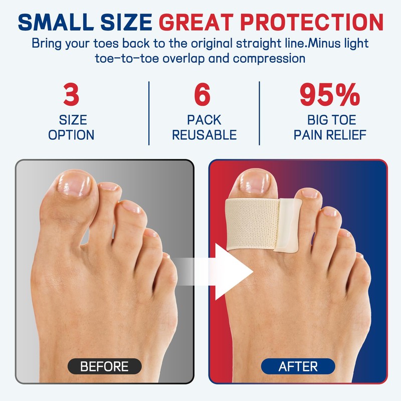 Toe Separator for Overlapping big Toes,Big Toe Spacers for Bunion,Toe